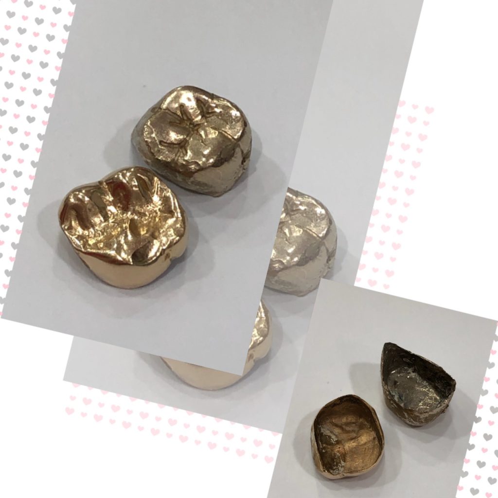 黃金假牙| JEWEL CAFE 三重店部落格